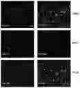 Fig. 07 - POLYHYDROXYLATED BILE ACIDS FOR TREATMENT OF BILIARY DISORDERS