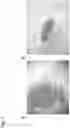 Fig. 02 - COMPOSITION COMPRISING HYDROGEN GAS FOR SUPPRESSION OR PREVENTION OF CANCER METASTASIS