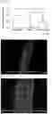 Fig. 08 - METHOD FOR TREATMENT OF INFERTILITY, PHARMACEUTICAL COMPOSITION FOR TREATMENT OF INFERTILITY AND METHOD FOR PRODUCING THE SAME