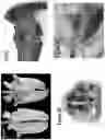 Fig. 06 - Microbiome transplantation