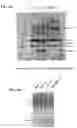 Fig. 11 - LIPOPROTEIN TARGETING PROTEASE INHIBITORS AND USES