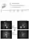 Fig. 02 - Immunotherapy for angiogenic disease