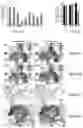 Fig. 03 - Immunoproteasome inhibitor