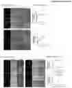 Fig. 16 - Method for blocking stress-induced tumor progression