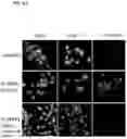 Fig. 06 - DPEP-1 binding compositions and methods of use