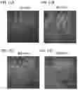 Fig. 15 - DPEP-1 binding compositions and methods of use