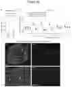 Fig. 13 - Methods and kits for treating pain