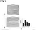 Fig. 05 - Methods and compositions for treating liver disease
