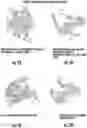 Fig. 03 - COMPOSITIONS AND METHODS TO PREVENT AND TREAT BIOFILMS