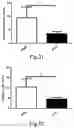 Fig. 09 - Method for treating coronary atherosclerosis and complications thereof