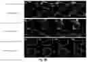 Fig. 11 - Activatable two-component photosensitizers