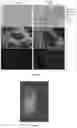 Fig. 07 - Epidermal growth factor receptor (EGFR) targeted photosensitizers