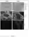 Fig. 13 - Epidermal growth factor receptor (EGFR) targeted photosensitizers