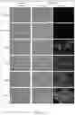 Fig. 14 - Epidermal growth factor receptor (EGFR) targeted photosensitizers
