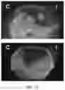 Fig. 10 - Imaging agents and methods of use