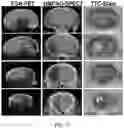 Fig. 11 - Imaging agents and methods of use