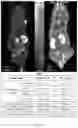 Fig. 14 - Structural molecule of peptide derivative for PSMA-targeting radiotherapy diagnosis and treatment
