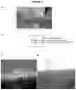 Fig. 04 - Use of self-assembling polypeptides as tissue adhesives