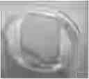 Fig. 01 - PROCESS FOR OBTAINING A FUNCTIONAL DERMAL SUBSTITUTE OF DECELLURIZED AMNIOTIC MEMBRANE FROM THE PLACENTA COMBINATION WITH KERATINOCYTES AND ITS USE AS AN AGENT FOR TISSUE REGENERATION OF THE SKIN
