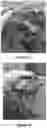 Fig. 02 - PROCESS FOR OBTAINING A FUNCTIONAL DERMAL SUBSTITUTE OF DECELLURIZED AMNIOTIC MEMBRANE FROM THE PLACENTA COMBINATION WITH KERATINOCYTES AND ITS USE AS AN AGENT FOR TISSUE REGENERATION OF THE SKIN