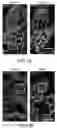 Fig. 04 - Synthetic hydrogel carriers for cellular structures, generation of organoids, and treatment of tissue injury