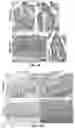 Fig. 08 - Synthetic hydrogel carriers for cellular structures, generation of organoids, and treatment of tissue injury