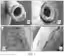 Fig. 02 - BIODEGRADABLE SILK EAR TUBES