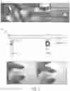 Fig. 03 - BIODEGRADABLE SILK EAR TUBES