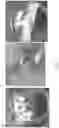 Fig. 06 - BIODEGRADABLE SILK EAR TUBES