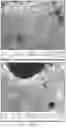 Fig. 08 - BIODEGRADABLE SILK EAR TUBES