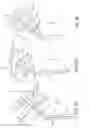 Fig. 05 - Method of removing excess fluid from a patient with hemodilution