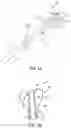 Fig. 07 - Method of removing excess fluid from a patient with hemodilution