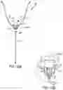 Fig. 11 - Method of removing excess fluid from a patient with hemodilution