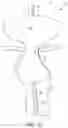 Fig. 16 - Method of removing excess fluid from a patient with hemodilution