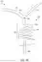 Fig. 17 - Method of removing excess fluid from a patient with hemodilution