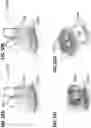 Fig. 48 - Breast pumps