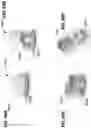 Fig. 56 - Breast pumps