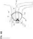 Fig. 10 - Impeller for use with axial shaft