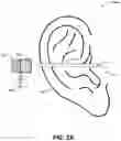 Fig. 03 - MICRO-DISPENSER BASED EAR TREATMENT