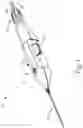 Fig. 02 - Apparatus for subretinal administration of therapeutic agent via a curved needle