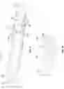 Fig. 09 - Variable single dose injector