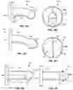 Fig. 05 - Customized Tracheocutaneous Fistula and Tracheostomy Plug