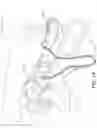 Fig. 02 - Humidifier for a respiratory therapy device