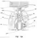 Fig. 04 - Adjustable resuscitation device and method for using the same