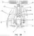 Fig. 05 - Adjustable resuscitation device and method for using the same