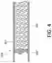 Fig. 08 - Flexible catheter