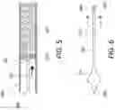 Fig. 09 - Flexible catheter