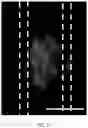 Fig. 12 - Antifouling urinary catheters with shape-memory topographic patterns