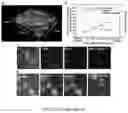 Fig. 18 - Antifouling urinary catheters with shape-memory topographic patterns