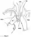 Fig. 08 - Trans-radial access endovascular catheter and method of use